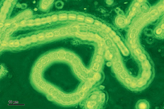 This image is a high-resolution microscopic view of filamentary strands of cyanobacteria, observed through a green filter.